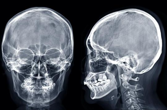 Un nouvel organe découvert dans le crâne humain