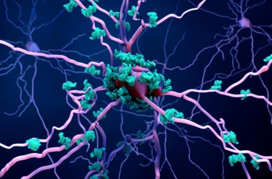 Alzheimer : le cholestérol impliqué dans la production de plaques bêta-amyloïdes