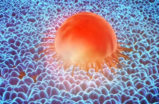 Cancer : un gène qui favorise les métastases et les résistances aux traitements identifié