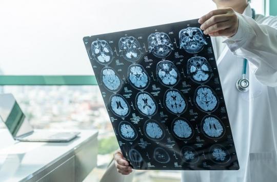 Tumeurs cérébrales : des biopsies 3D pour mieux les étudier