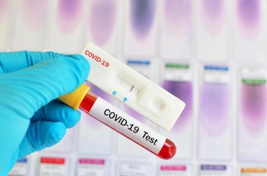 Les tests sérologiques, un complément selon la Haute Autorité de santé
