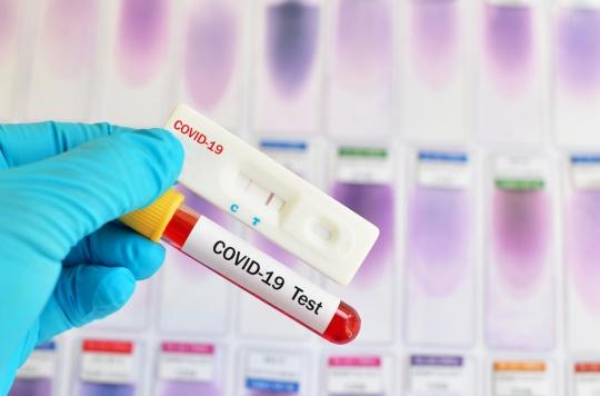 Coronavirus : pourquoi sommes-nous loin des 700 000 tests par semaine promis par Edouard Philippe?