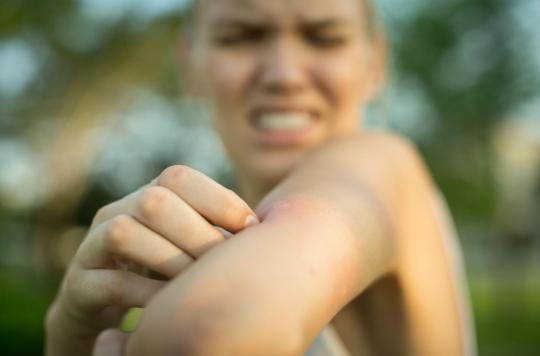 How to soothe the skin after mosquito bites? 