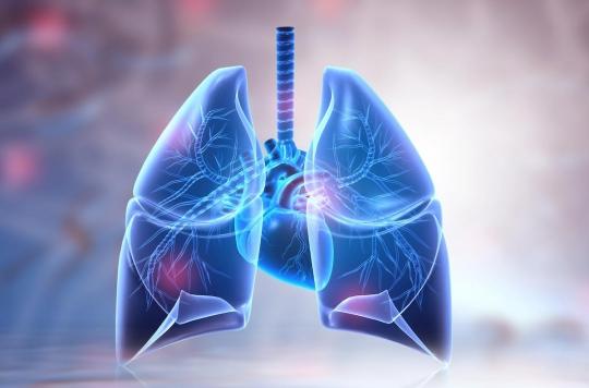 Cancer du poumon : chez les non-fumeurs, des signatures génétiques différentes