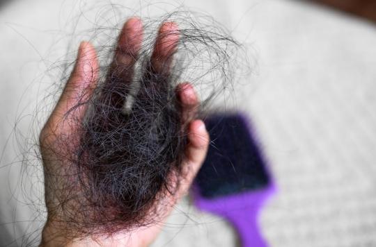 Alopécie : Jada Pinkett Smith assume sa perte de cheveux 