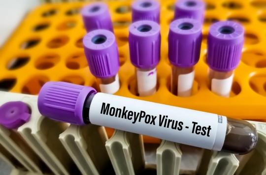 Variole du singe : les tests de dépistage remboursés à 100 % 