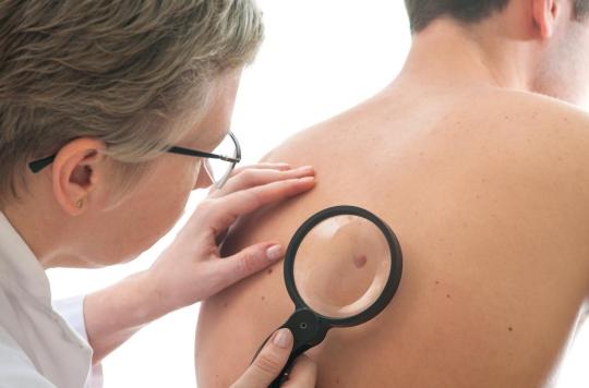 Pour éviter un cancer grave, il faut surveiller les taches sur la peau