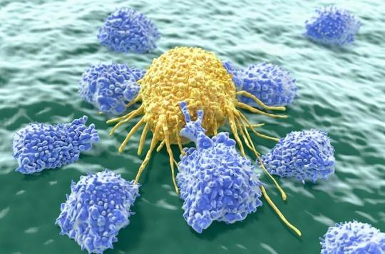 Lymphome B à grandes cellules : efficacité des lymphocytes génétiquement modifiés (CAR-T)
