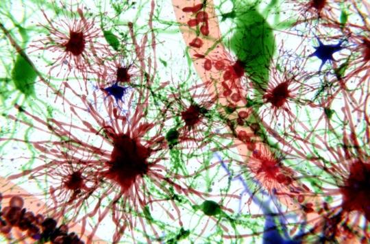 Epilepsie : un nouveau modèle révolutionne la compréhension de la maladie