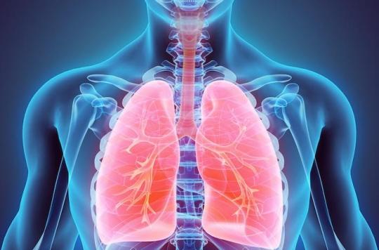 Le cancer du poumon au stade avancé pourrait se passer de la chimiothérapie