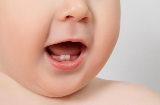 Des chirurgiens découvrent des dents dans le cerveau d’un bébé