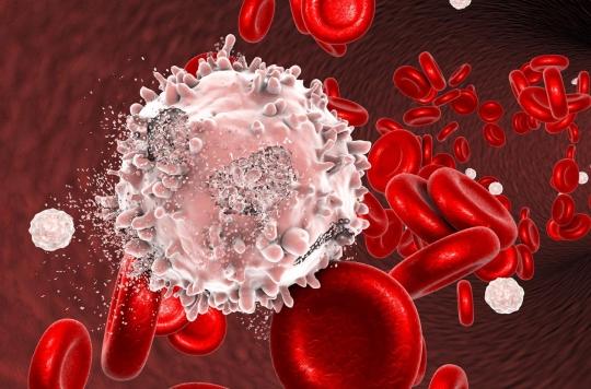 Leucémie : des « cellules tueuses » programmées contre les cellules malignes