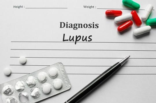 Lupus : un traitement potentiel donne des résultats encourageants