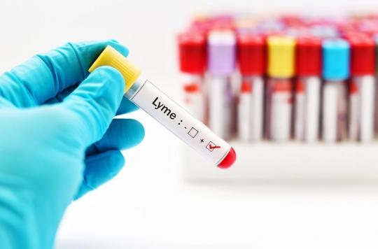 Maladie de Lyme : un nouveau test pour la détecter à un stade précoce