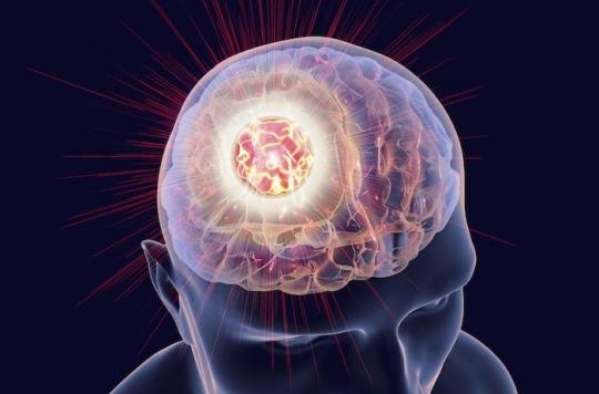 L'Androcur, ce traitement contraceptif qui multiplie les risques de tumeur au cerveau