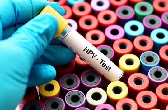 Cancer du col de l'utérus : des médecins et des patients militent pour privilégier le test HPV 