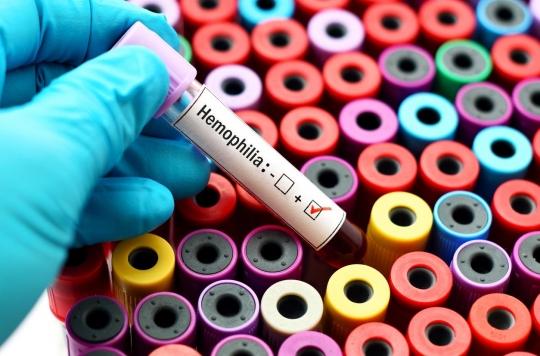 Hémophilie A : un nouveau traitement génique offre un espoir aux malades