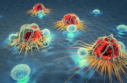 Cancer : des chercheurs découvrent 11 gènes responsables de 99% des métastases