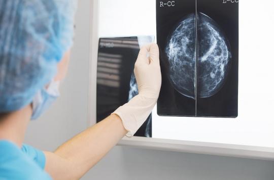 Cancer du sein : comment les tumeurs se propagent dans les ganglions 