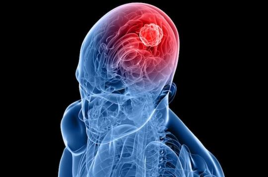 Immunothérapie : avancée dans le traitement des tumeurs cérébrales 