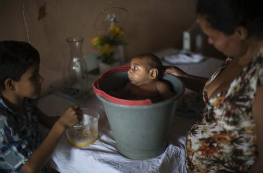 Virus Zika : 3 000 cas de microcéphalie au Brésil