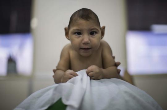 Zika Des Bebes Ont Developpe Une Microcephalie Apres La Naissance