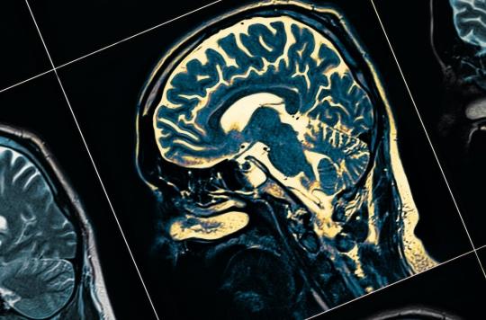 Une étude suggère un lien entre le trouble bipolaire et la maladie de Parkinson