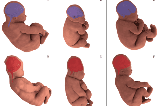 Des images 3D montrent comment la tête des nourrissons se déforme pendant l’accouchement