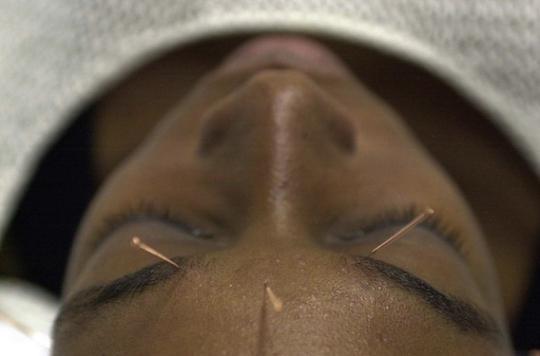 Douleurs du cou : l'acupuncture fait ses preuves