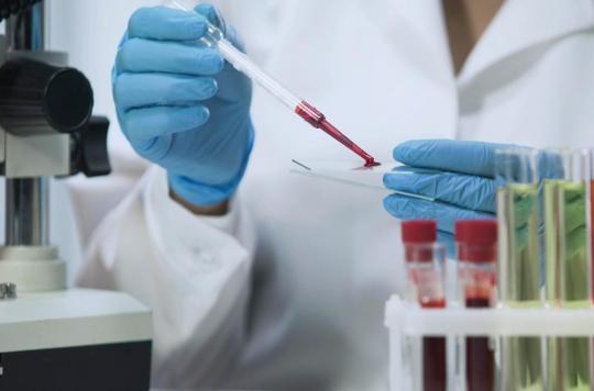 VIH : des chercheurs ont peut-être enfin découvert comment tuer le virus