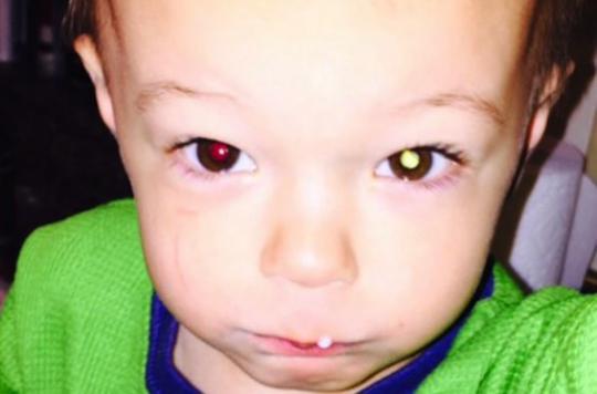 Rétinoblastome : un petit Américain sauvé grâce à une photo