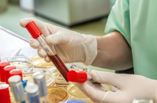 VIH : un test sanguin repère 70 fois plus de virus dormants