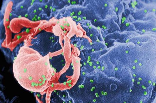 Sida : le VIH reste caché dans le tissu graisseux