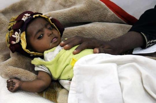 Yémen : plus de 460 000 enfants en danger de mort 