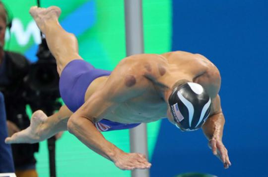 Rio 2016 : pourquoi les ventouses séduisent les athlètes