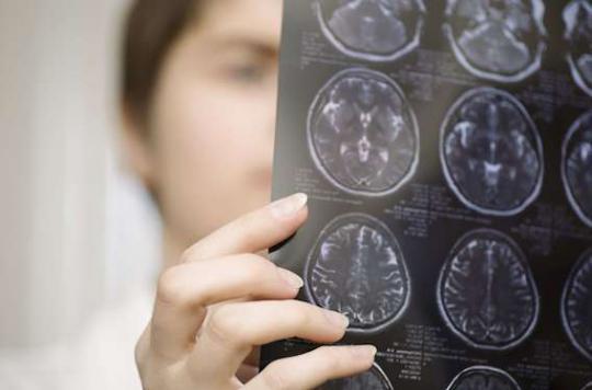 Alzheimer : les premiers signes 18 ans avant le diagnostic