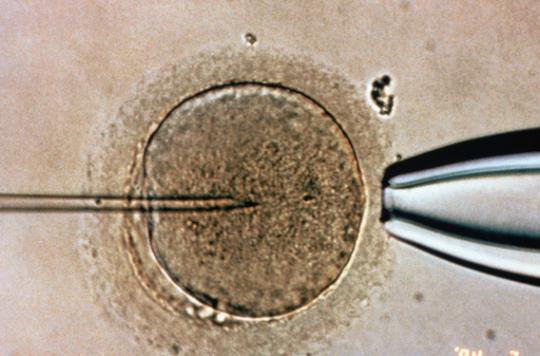 Donneur de sperme : un droit à l'anonymat et un devoir moral