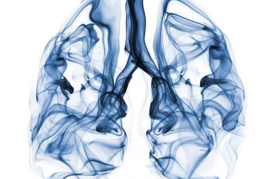 Cancer du poumon : le dépistage par le risque individuel supérieur au scanner du poumon