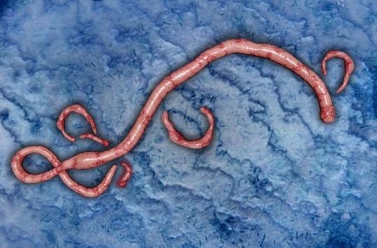 Ebola : le virus laisse des lésions sur la rétine des survivants