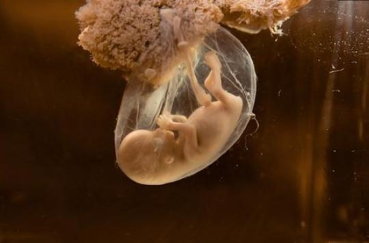 Grossesse La Prise D Ibuprofene Au 1er Trimestre Affecte La Fertilite Des Petites Filles