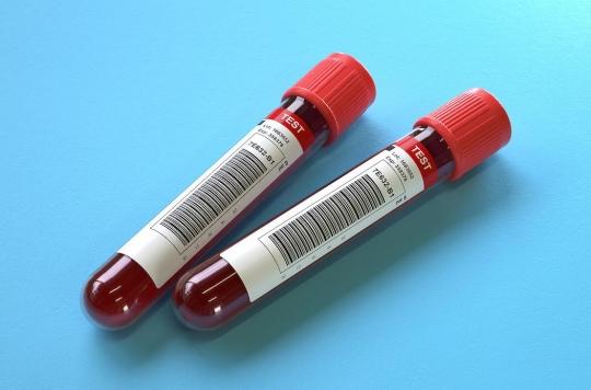 Un essai mené sur 10 000 femmes étudie l'efficacité d’un test sanguin pour détecter plusieurs cancers