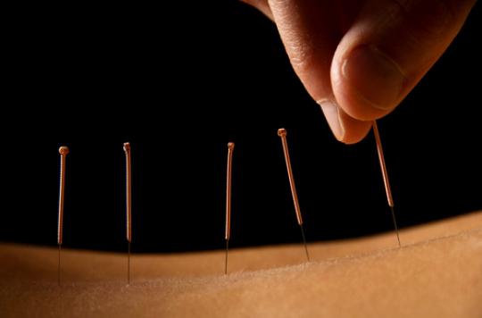 Mémoire : l’acupuncture serait efficace dans les troubles légers