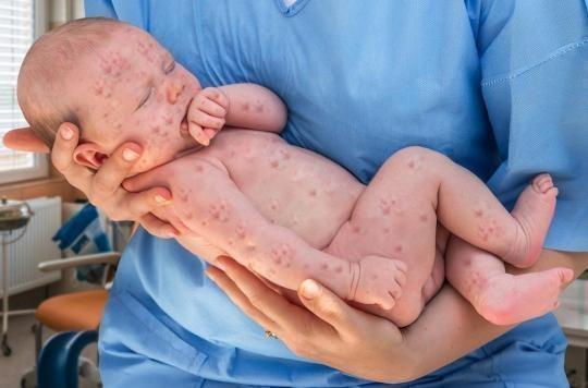 Suspicion de rougeole : un bébé de 10 mois meurt aux urgences à Agen 