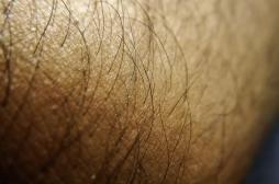 Des scientifiques créent pour la première fois de la peau humaine avec des poils