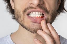 Covid-19 : une bonne hygiène bucco-dentaire protège