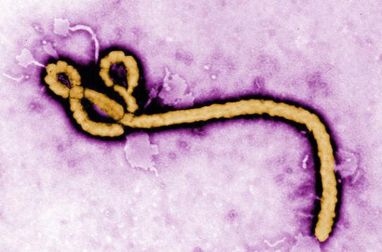 Ebola : le virus présent dans le sperme pendant neuf mois