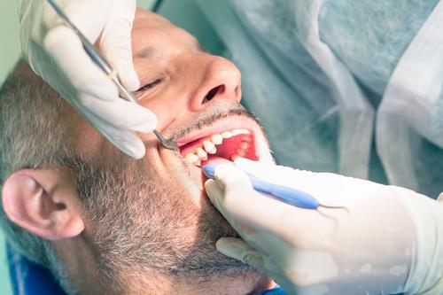 Dents : un médicament anti-Alzheimer accélère la réparation