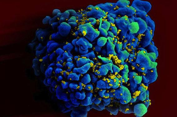 SIDA : des chercheurs découvrent des failles du virus