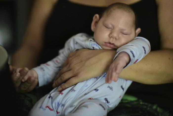 Zika : 10 % des femmes enceintes ont eu un enfant atteint de malformation