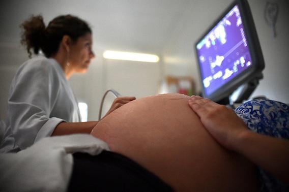 Zika : une Brésilienne sur deux évite de tomber enceinte